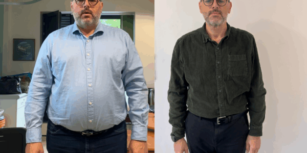 A two photo collage of the same man. He is noticeably thinner in the righthand side picture. He is standing straight ahead and looking slightly downwards.